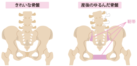 一般的に言われる産後の骨盤変位の原因とは