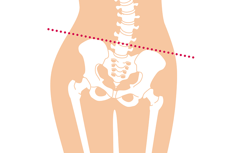 原因①:首や肩は被害者！骨盤や背骨のアンバランスが犯人