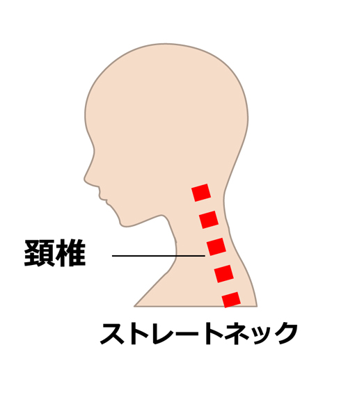 病院や接骨院でのアプローチ