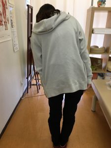 ギックリ腰の女性